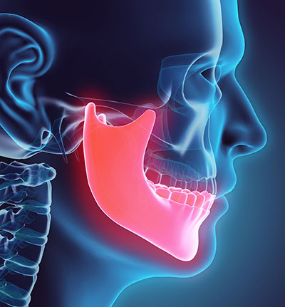 Computerized image of a skull and jawbone from Surprise Oral & Implant Surgery in Surprise, AZ