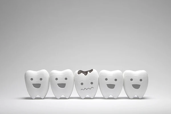 Row of five toy teeth, all smiling except for the middle tooth which frowns because of tooth decay illustrated by Surprise Oral & Implant Surgery in Surprise, AZ