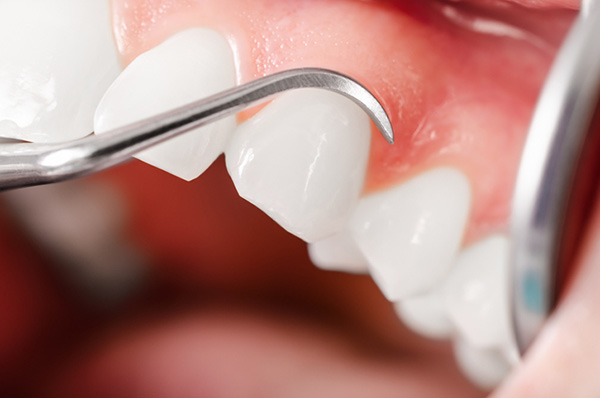 a close up of healthy gums and pearly teeth